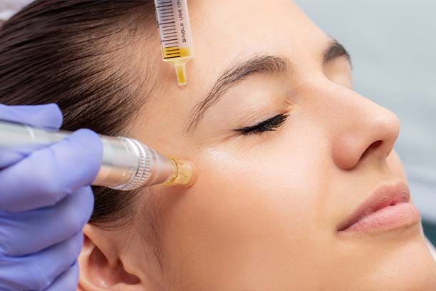 Face PRP Clinic in GK, Delhi