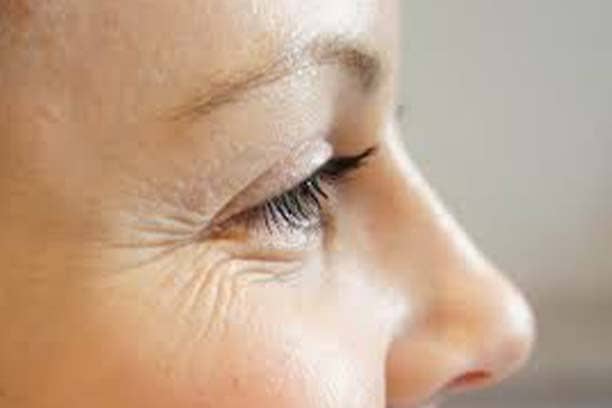 Wrinkles Treatment Clinic in Delhi